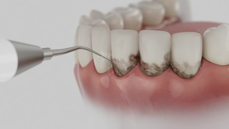 Reliable Dental contractor in Tooele, UT by Smile Center Dentistry